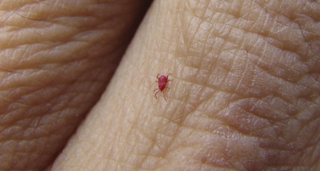 Bites from autumn grass mites produce intensely itchy wheals on the skin